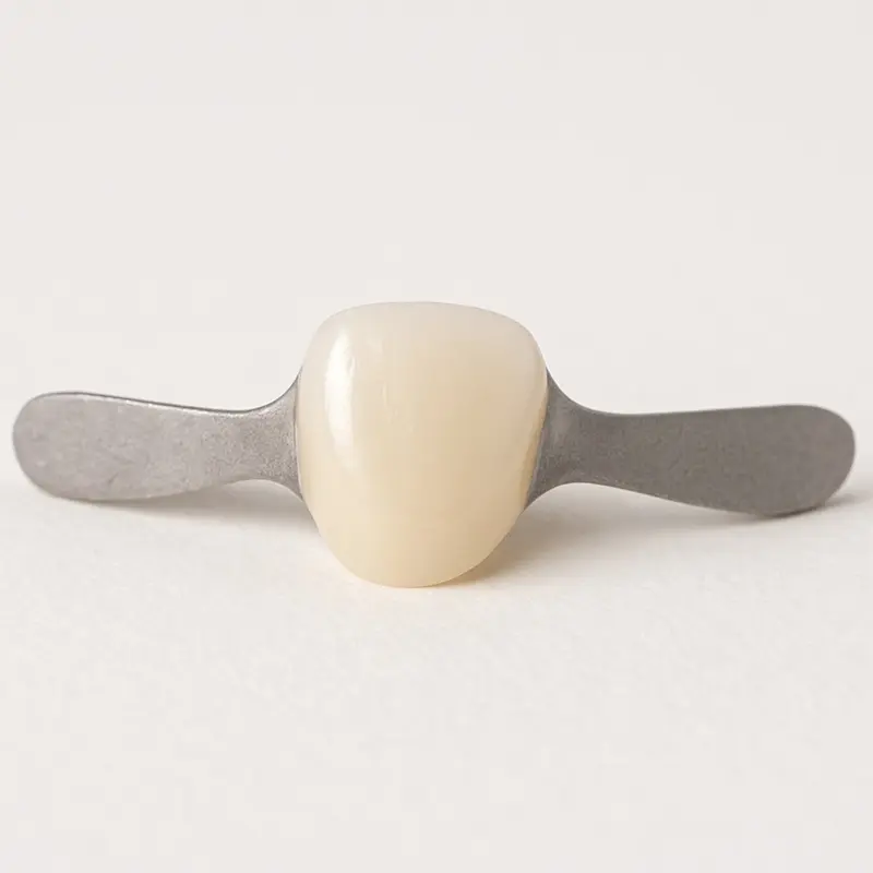 MarylandBridge Maryland Bridge dental prosthesis with a ceramic tooth and two metal wings on a light background