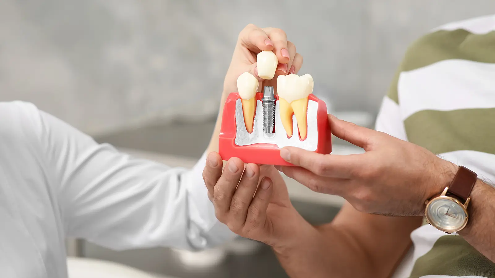 All-On-4 Implants vs. Implant-Supported Dentures: What’s the Difference?
