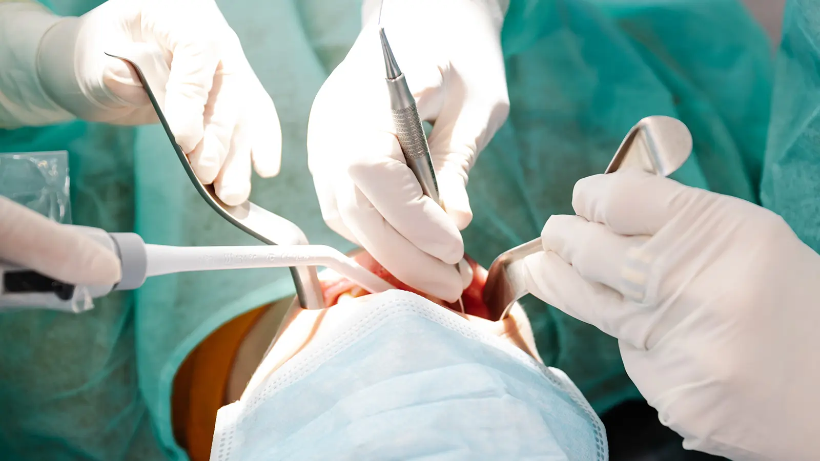 Oral Surgery Care for Broadway Residents