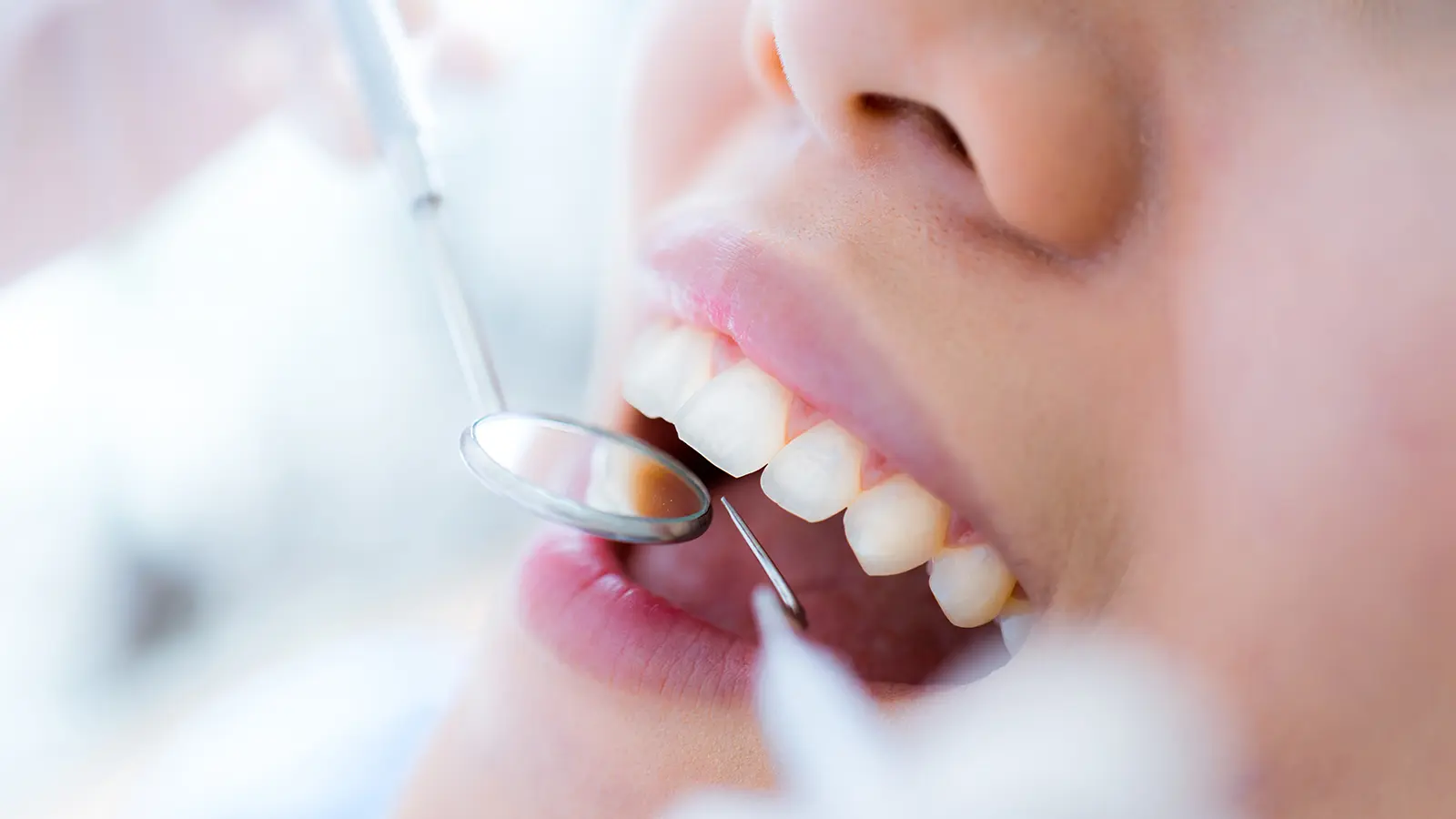 Does Gum Disease Affect Dental Implants? Understanding Peri-Implantitis